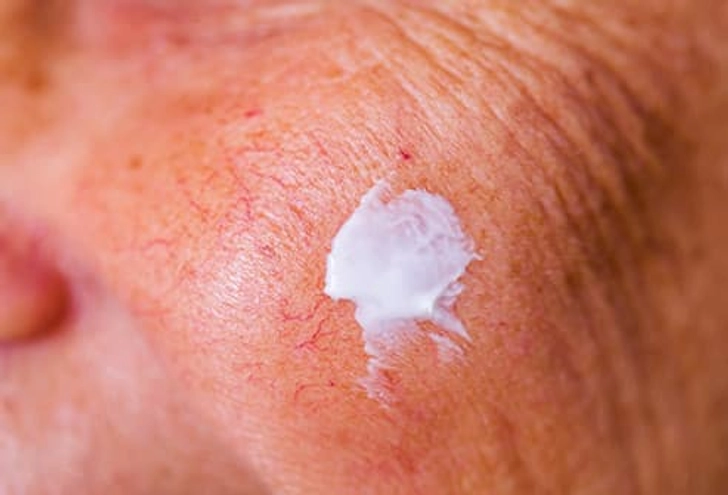 Medications You Put on Your Skin