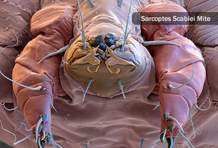Skin Parasites Skin Parasites
