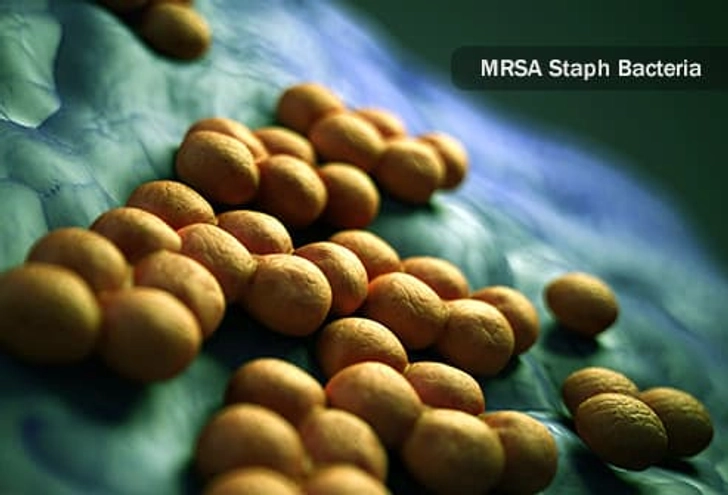 MRSA