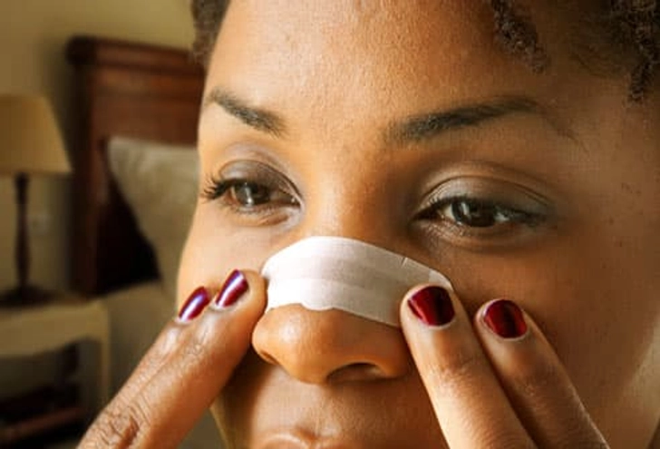 Use Nasal Strips
