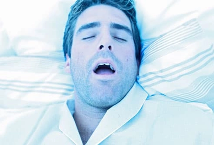 Sleep Apnea