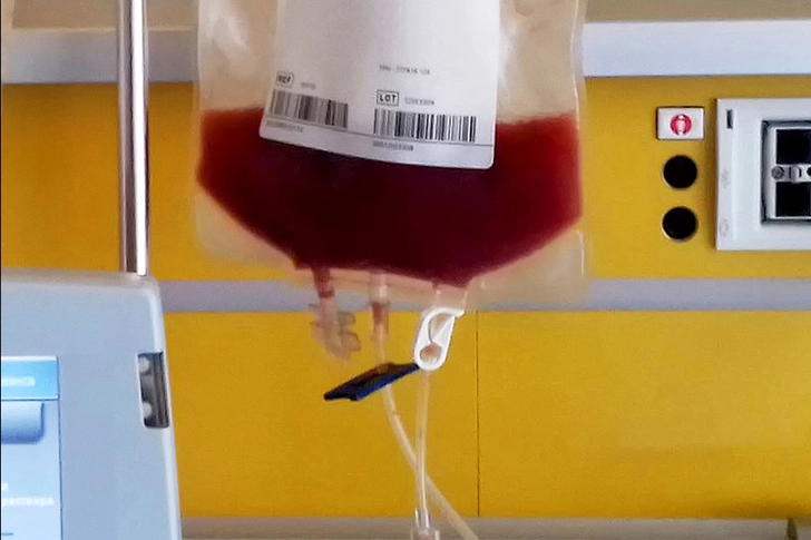 Are You Healthy Enough for a Stem Cell Transplant?