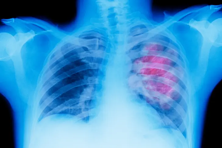 After the Diagnosis