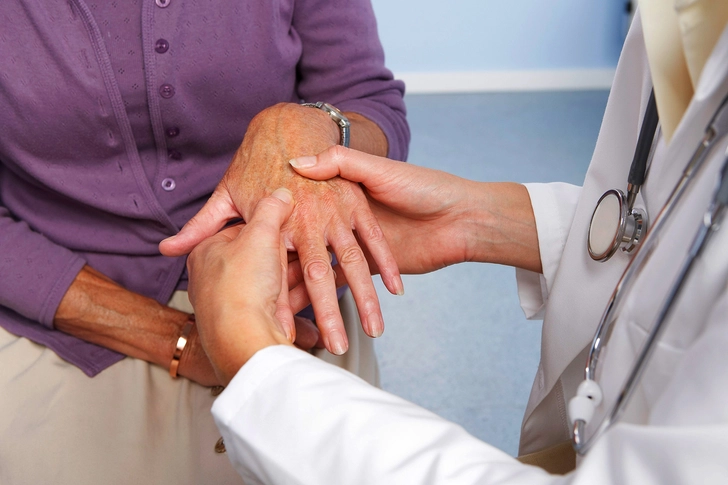Arthritis Arthritis