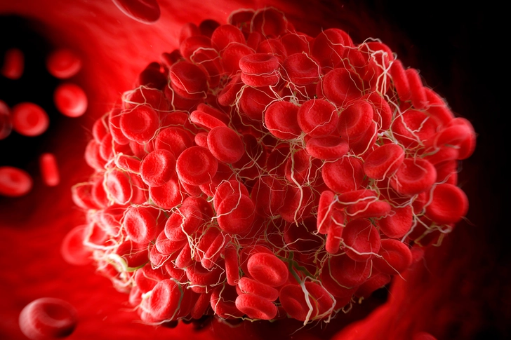 Blood Clots