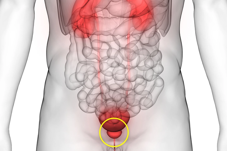 Prostate Cancer