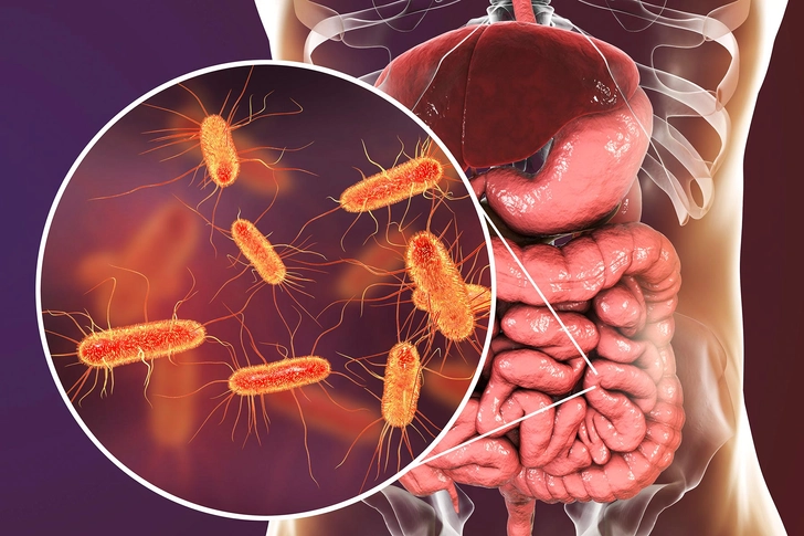 Anti-Inflammatory Diet (IBD-AID) Anti-Inflammatory Diet (IBD-AID)