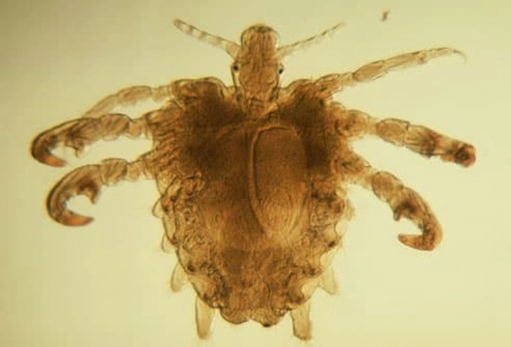 Crabs (Pubic Lice)