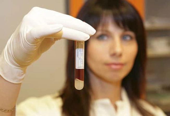 HIV/AIDS Tests HIV/AIDS Tests