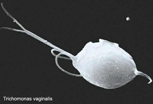Trichomoniasis Trichomoniasis