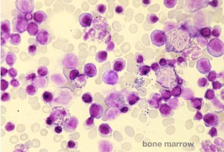 Harvesting Stem Cells