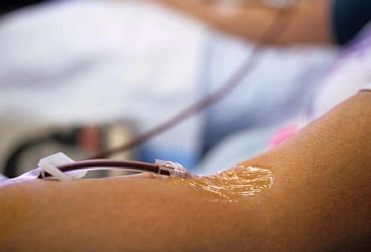 Some Donors Also Need Recovery Time