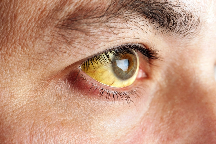 Metastatic Bladder Cancer Symptoms Metastatic Bladder Cancer Symptoms