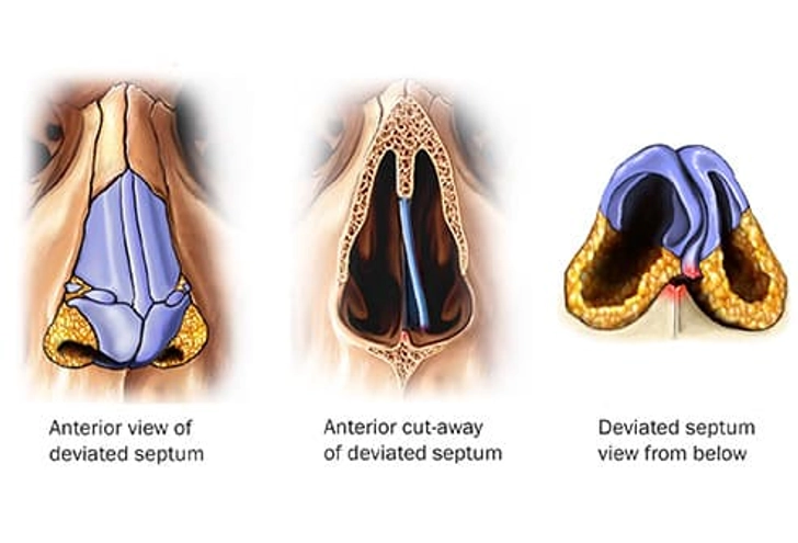 The Shape of Your Nose The Shape of Your Nose
