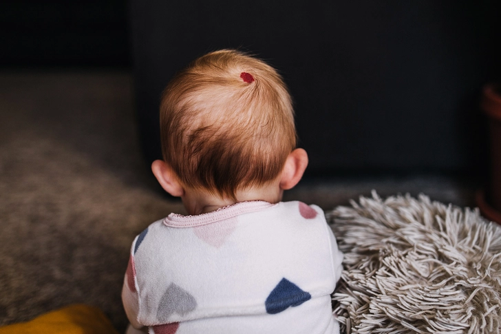 Some birthmarks will disappear.