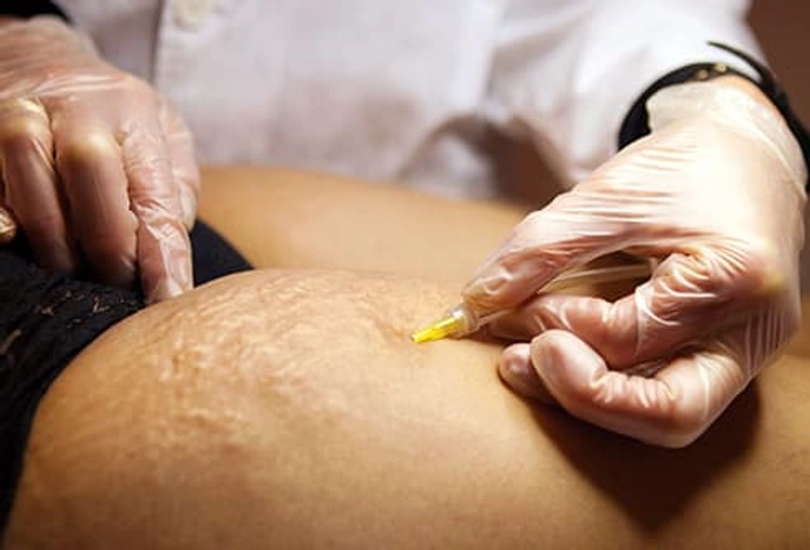 See a Dermatologist See a Dermatologist