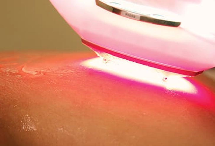 What May Help: Laser Therapy What May Help: Laser Therapy