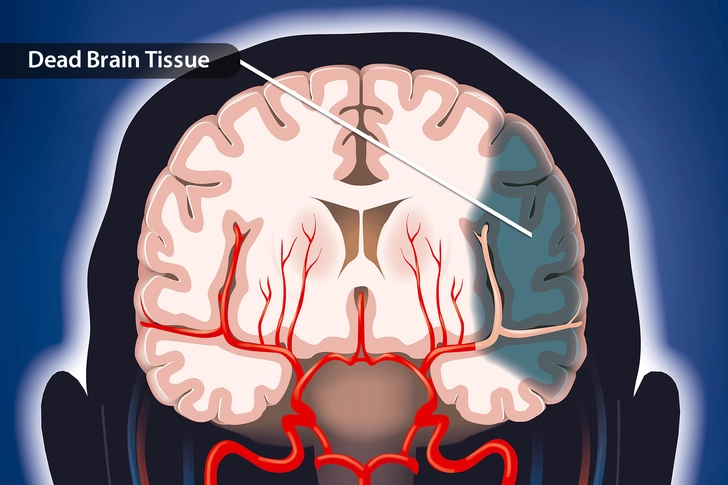 Time = Brain Damage