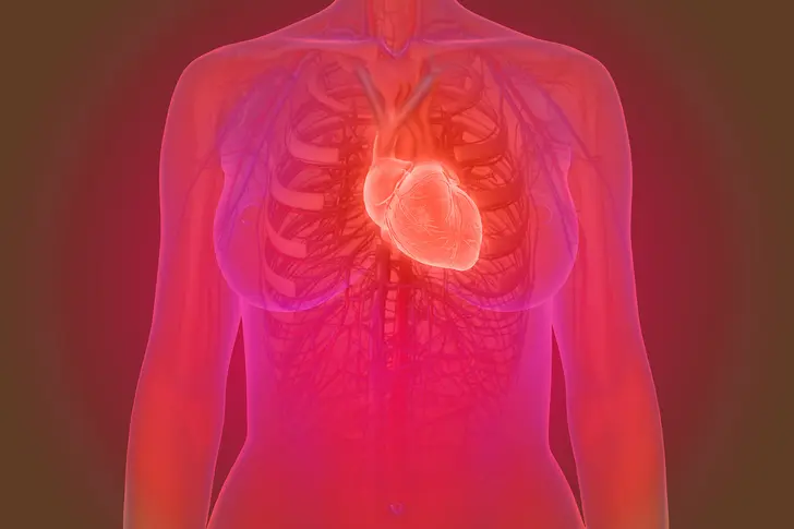 Women and Heart Attacks Women and Heart Attacks
