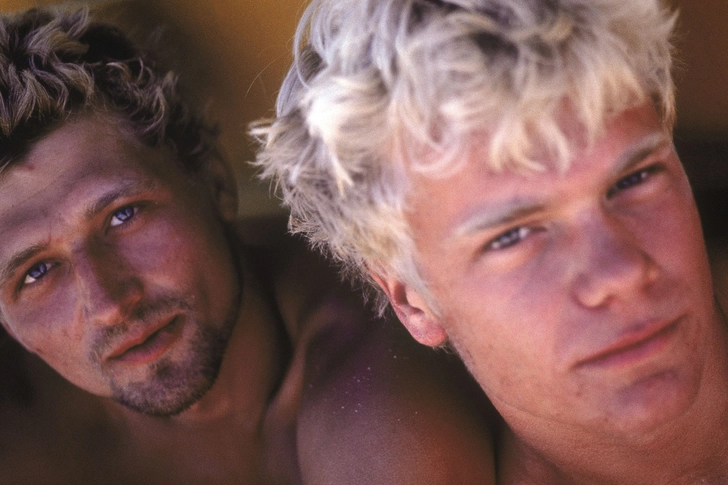 Sunburn (First-Degree Burns)