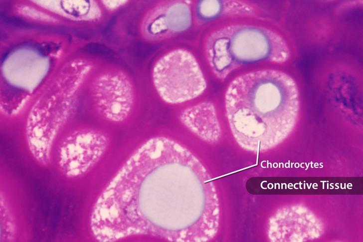 Chondroitin Chondroitin
