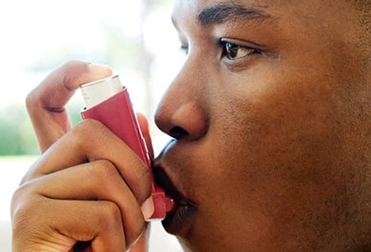 Asthma Asthma