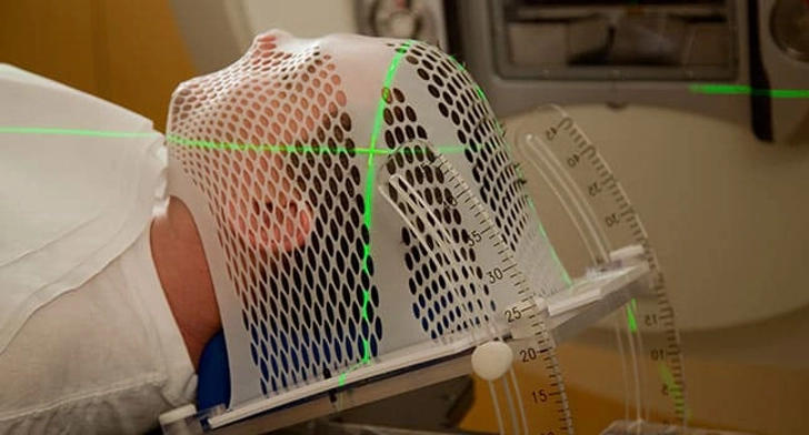 Radiation Therapy