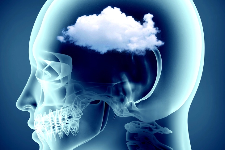 Foggy Brain Foggy Brain