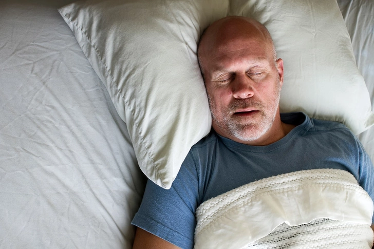 Sleep Apnea Sleep Apnea