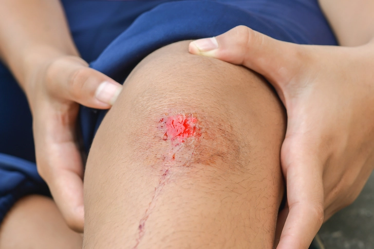 Treat Minor Injuries