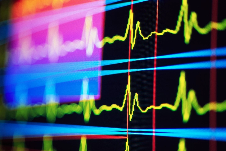 Postural Orthostatic Tachycardia Syndrome (POTS) Postural Orthostatic Tachycardia Syndrome (POTS)