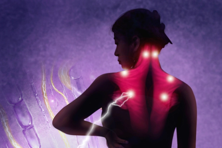 Fibromyalgia Fibromyalgia