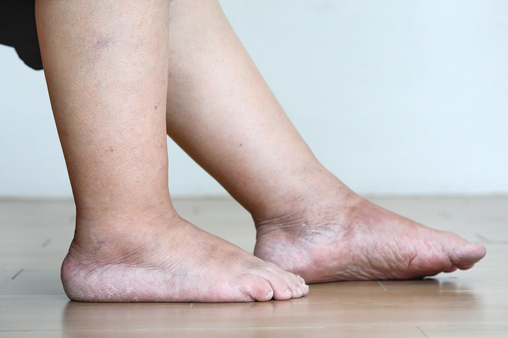 When to Call Your Doctor About MASH When to Call Your Doctor About MASH