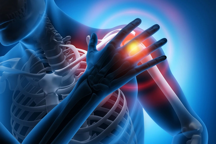 Joint Pain