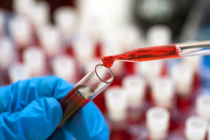 Catching Liver Disease Sooner