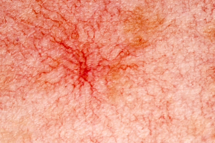 Red Palms and ‘Spider Webs’
