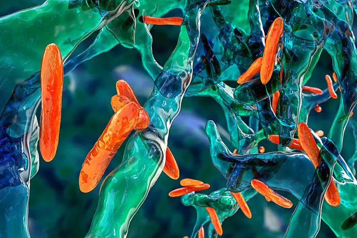 What Is Mycobacterium Avium Complex (MAC)?