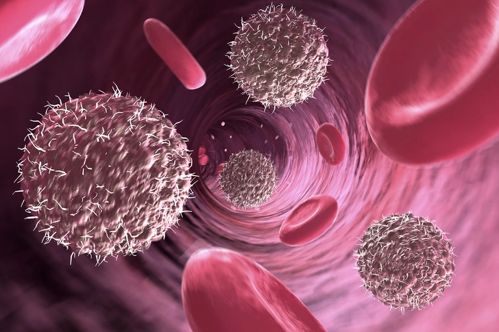 What Happens When CLL Progresses?