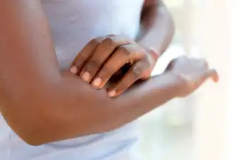 Tips for Your Eczema Journey Tips for Your Eczema Journey