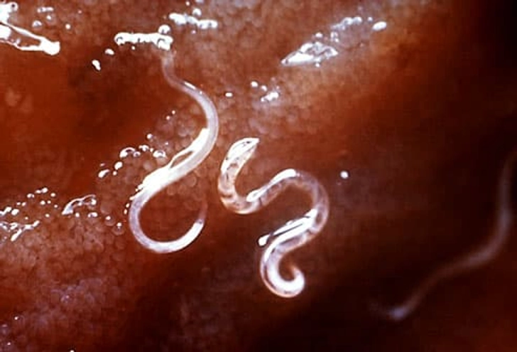 Get Rid of Puppy's Parasites Get Rid of Puppy's Parasites