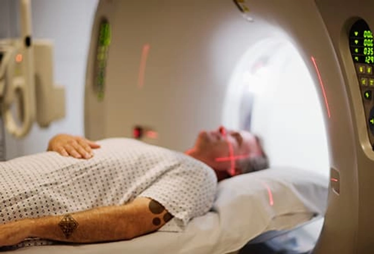 MRI Complications
