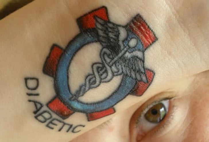 Types: Medical Tattoos