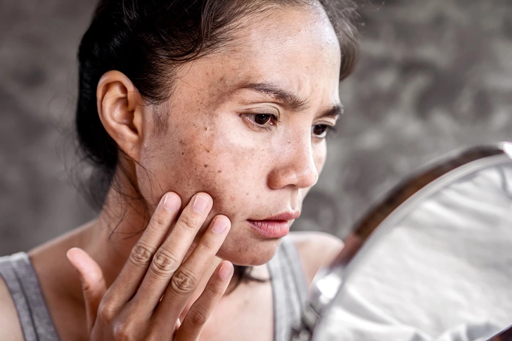 Might Lighten Dark Spots