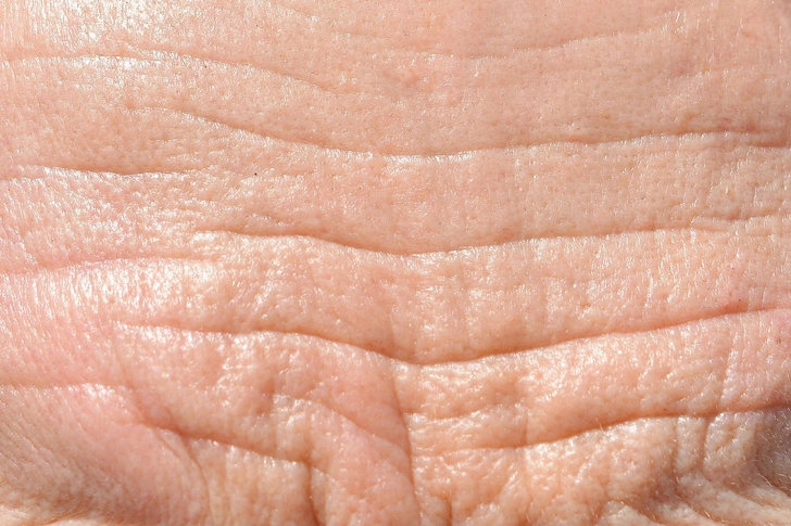 Helps Smooth Wrinkles