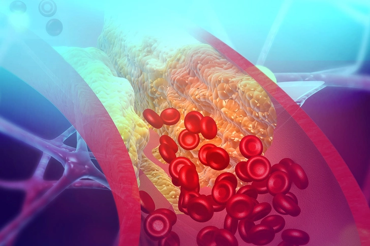 Chicken and Cholesterol