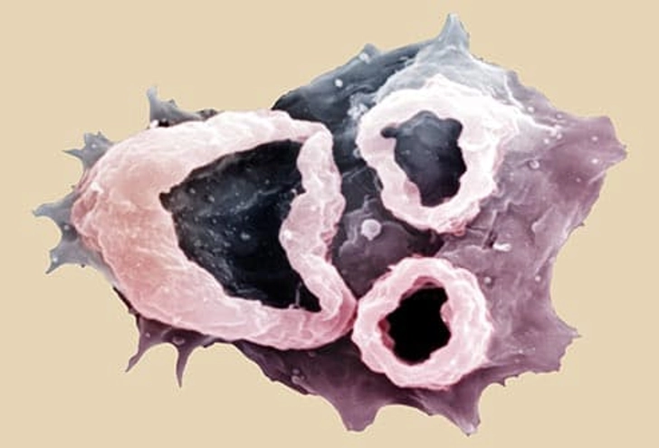 Naegleria Fowleri