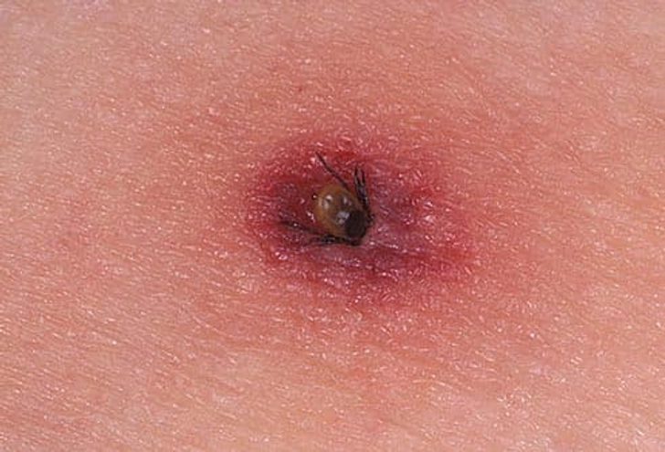 Ticks