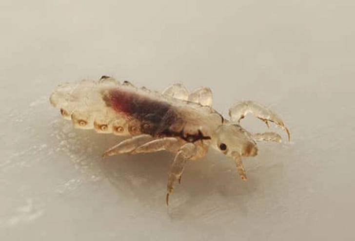 Lice
