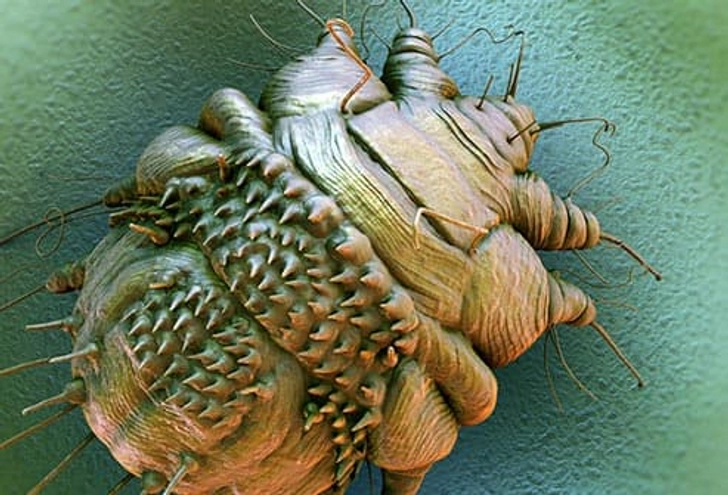 Scabies