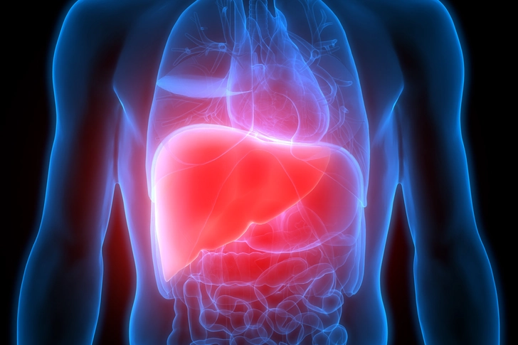 Organ Failure